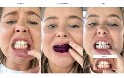 Paski wybielające – 7-dniowy program